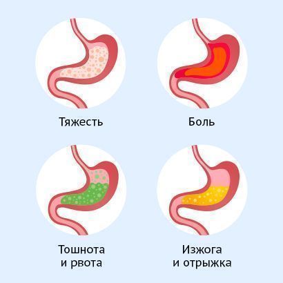 Признаки хронического гастрита