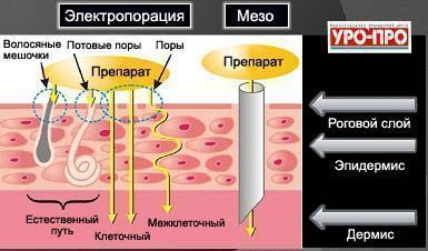 процесс электропорации