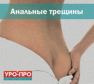 Анальные трещины Анальные трещины