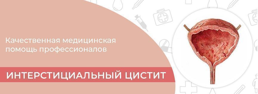 После лучевой цистит. Лучевой цистит у мужчин после лучевой терапии.