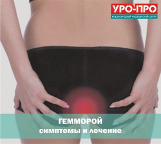 Геморрой: симптомы и лечение Геморрой: симптомы и лечение