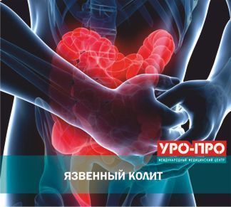 Язвенный колит Язвенный колит