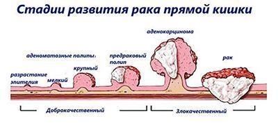 Классификация.jpg