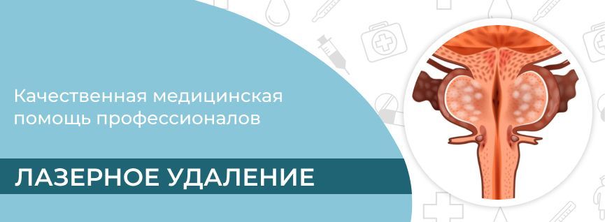 Баннер