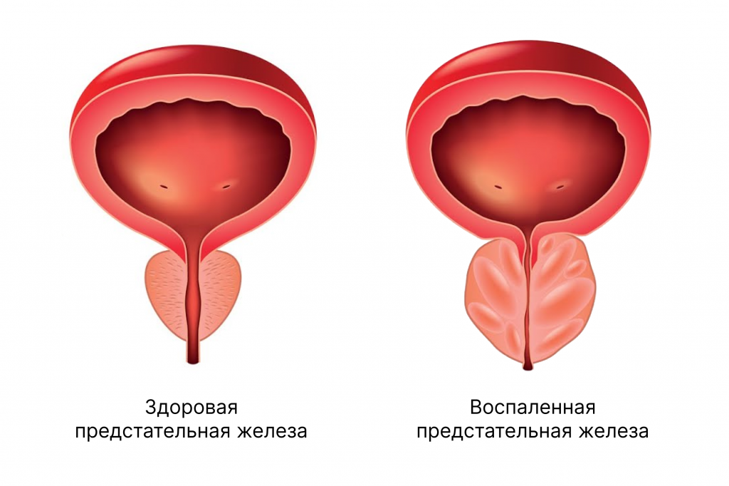 классификация.png классификация.png