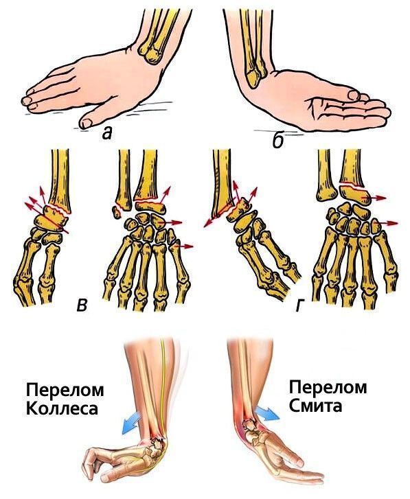 Строение лучезапястного сустава