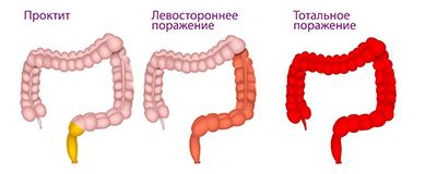 Разновидности.jpg
