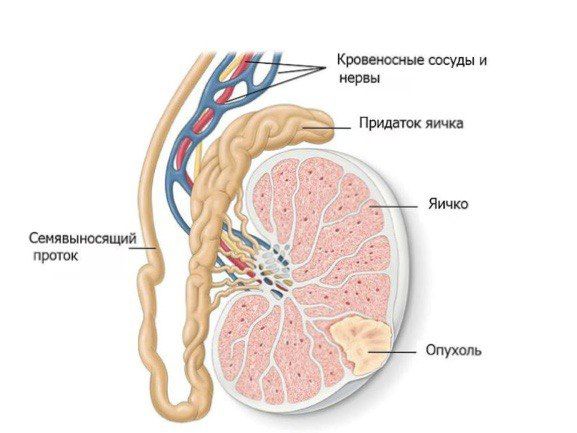 симптомы опухоли яичек.jpeg симптомы опухоли яичек.jpeg