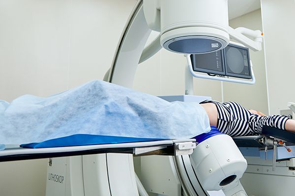 Дистанционная литотрипсия в клинике УРО-ПРО Краснодар