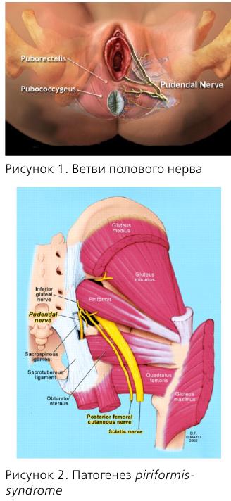 Синдром внутренней обтураторной мышцы лечение