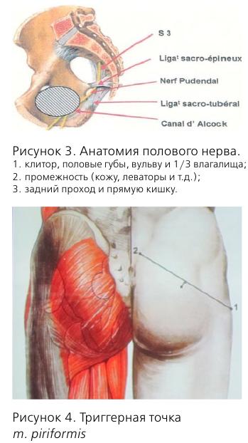 Синдром внутренней обтураторной мышцы лечение