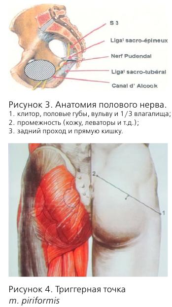 Синдром канала алкока у мужчин