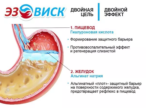 Эзовиск