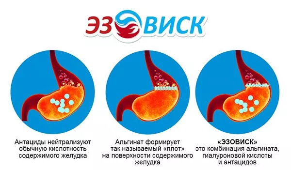 Эзовиск